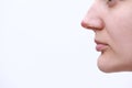 Herpes on the nose - Pretty young woman with herpes her on nose. Human Virus. Close Up of Nose with herpes simplex infection and Royalty Free Stock Photo