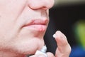 Herpes simplex virus infection. Lips treatment by cream. Male face.