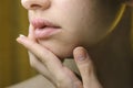 Beautiful Woman Applying Ointment on Her Upper Lip with Herpes. Royalty Free Stock Photo