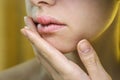 Beautiful Woman Applying Ointment on Her Upper Lip with Herpes. Royalty Free Stock Photo