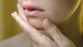 Beautiful Woman Applying Ointment on Her Upper Lip with Herpes. Royalty Free Stock Photo