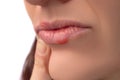 Herpes virus. Herpes disease on the lips of a 30 year old woman. Infectious virus. Close-up of the manifestation of herpes on the Royalty Free Stock Photo