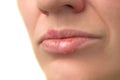 Herpes virus. Herpes disease on the lips of a 30 year old woman. Infectious virus. Close-up of the manifestation of herpes on the Royalty Free Stock Photo