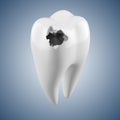 Hhuman tooth with caries