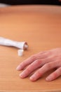 Crop female hand with chilblain near open white tube of medical unguent for skin treatment on wooden table Royalty Free Stock Photo