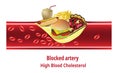 High blood cholesterol, Junk Food