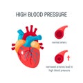 Blood pressure concept in flat style, vector Royalty Free Stock Photo