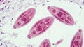 Microscopic View of Liver Fluke Parasites Under Staining Royalty Free Stock Photo