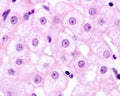 Human hepatocyte. Nucleolus Royalty Free Stock Photo