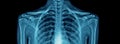 High quality chest x-ray and shoulder and clavicle Royalty Free Stock Photo