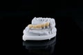 High-quality dental prosthesis bridge made of zirconia and ceramic crowns on the model from bite position. Royalty Free Stock Photo