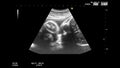 High quality ultrasound echography check. Gynecological medical examination. 33 weeks old pregnancy