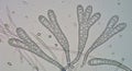 Bright field light microscope image of club shaped macroconidia of Trichophyton mentagrophytes dermatophyte Royalty Free Stock Photo
