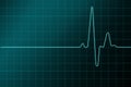 High resulation cardiogram