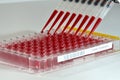 high throughput screening of covid-19 samples with a multichannel pipet in a microtiter plate large scale Royalty Free Stock Photo