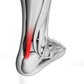 Highlighted achilles tendon Royalty Free Stock Photo