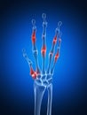 Highlighted arthritic hand Royalty Free Stock Photo
