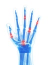 Highlighted arthritic hand Royalty Free Stock Photo