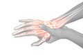 Highlighted bones of woman with hand pain Royalty Free Stock Photo