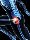 Highlighted hip joint