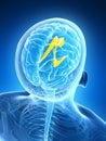 Highlighted lateral ventricle Royalty Free Stock Photo