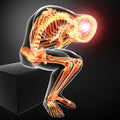 Highlighted male body skeleton with migraine