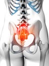 Highlighted sacrum