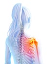 Highlighted shoulder joint