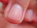 Highly detailed macro shot of adult male index fingernail