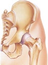 Hip - Joint and Bones in Situ