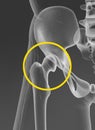 Hip joint, pelvis, medically artwork Royalty Free Stock Photo