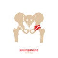 Hip osteoarthritis icon