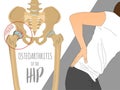 Hip Osteoarthritis Infographic