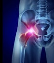 Hip Pain Royalty Free Stock Photo