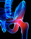 Hip painful skeleton x-ray, 3D illustration. Royalty Free Stock Photo