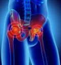 Hip painful skeleton x-ray, 3D illustration. Royalty Free Stock Photo