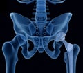 Hip replacement implant installed in the pelvis bone. X-ray view.