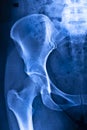 Hips pelvis xray scan