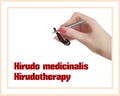 Hirudotherapy. Treatment with leeches. Royalty Free Stock Photo