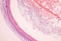 Histological Ovary, Testis and Sperm human cells under microscope.