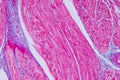Histological sample Heart muscle Tissue under the microscope.