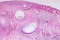 Histological sample Ovary of rabbit Tissue under the microscope. Royalty Free Stock Photo