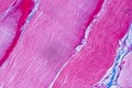 Histological sample Striated Skeletal muscle of mammal Tissue under the microscope. Royalty Free Stock Photo