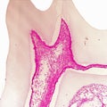Histological section of molar tooth.