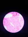 Histological Slide of Liver seen from microscope.