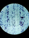 Histological slide of a tissue sample. Close microscopic view. Histopathology