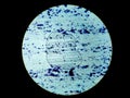 A histological slide of a tissue sample. Close microscopic view. Histopathology