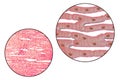 Histological structure of heart muscle