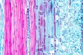 Histological structure of pine stem vascular bundle under microscope