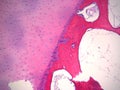 Histology Bone stained H&E